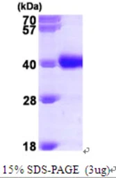 Human GALE protein, His tag. GTX67401-pro