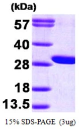 Human GAMT protein, His tag. GTX67404-pro