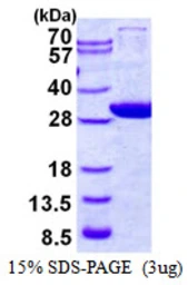 Human GCLM protein, His tag. GTX67412-pro