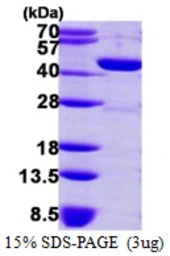 Human GMDS protein, His tag. GTX67416-pro