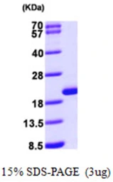 Human GMF beta protein, His tag. GTX67417-pro