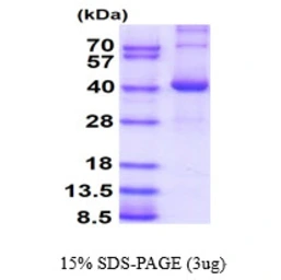 Human GMPR1 protein, His tag. GTX67418-pro