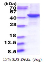 Human GNAQ protein, His tag. GTX67422-pro