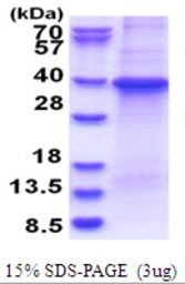Human GNB1 protein, His tag. GTX67424-pro