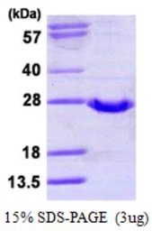 Human GPX2 protein, His tag. GTX67432-pro