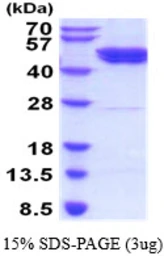 Human GSK3 beta protein, His tag. GTX67435-pro