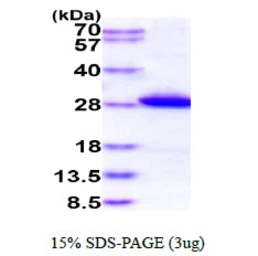 Human GSTM1 protein, His tag. GTX67438-pro