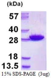 Human GSTM5 protein, His tag. GTX67441-pro