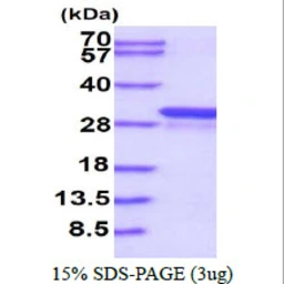 Human GSTT1 protein, His tag. GTX67442-pro