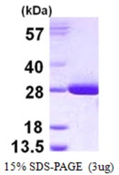 Human GSTT2 protein, His tag. GTX67443-pro