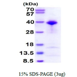 Human TFIIB protein, His tag. GTX67444-pro