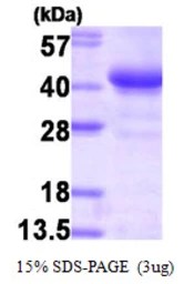 Human Glycogenin 1 protein, His and T7 tag. GTX67448-pro