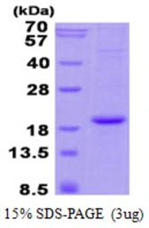Human Hemoglobin alpha 2 protein, His tag. GTX67452-pro