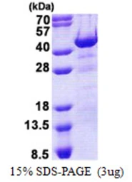Human Hex protein, His tag. GTX67458-pro