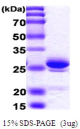 Human HMGB1 protein, His tag. GTX67464-pro