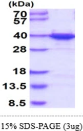 Human hnRNP A1 protein, His tag. GTX67470-pro