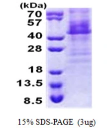 Human HOXC11 protein, His tag. GTX67474-pro