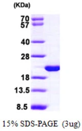 Human HPCAL1 protein, His tag. GTX67475-pro