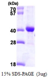 Human DNAJB2 protein, His tag. GTX67482-pro