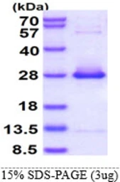 Human HSPB2 protein, His tag. GTX67488-pro