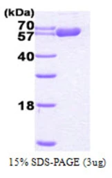 Human HSP60 protein, His tag. GTX67490-pro