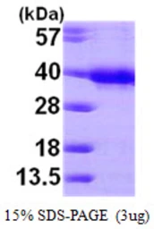 Human HUS1 protein, His tag. GTX67493-pro