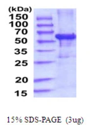 Human IFIT3 protein, His tag. GTX67497-pro