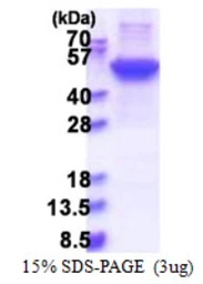 Human Cytokeratin 17 protein, His tag. GTX67515-pro