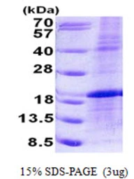 Human LMO1 protein, His tag. GTX67523-pro