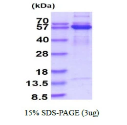 Human SMAD2 protein, His tag. GTX67529-pro