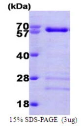 Human SMAD4 protein, His tag. GTX67531-pro