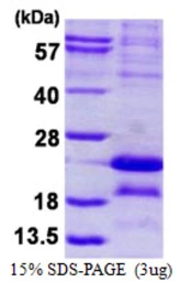 Human MAGEA5 protein, His tag. GTX67535-pro