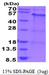 Human MAGEA8 protein, His tag. GTX67537-pro