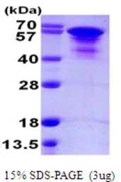 Human Tau protein, His tag. GTX67540-pro