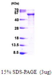 Human Tau protein, His tag. GTX67542-pro
