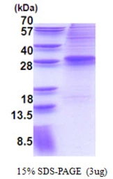 Human EVI1 protein, His tag. GTX67549-pro