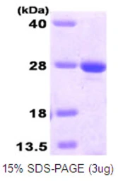Human MGMT protein, His tag. GTX67551-pro