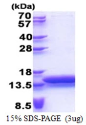 Human MTCP1 protein, His tag. GTX67563-pro
