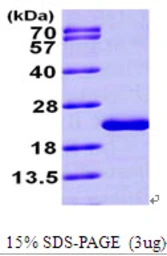 Human MTH1 protein, His tag. GTX67564-pro