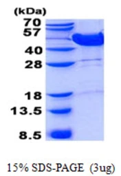 Human MVK protein, His tag. GTX67566-pro
