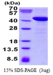 Human NCF4 protein, His tag. GTX67578-pro