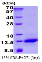 Human NDUFA2 protein, His tag. GTX67580-pro