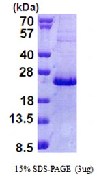 Human NHLH2 protein, His tag. GTX67591-pro