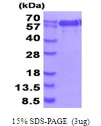 Human NMT1 protein, His tag. GTX67597-pro