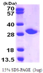 Human NNMT protein, His tag. GTX67598-pro