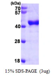 Human OAS1 protein, His tag. GTX67601-pro