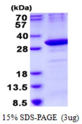 Human OAZ1 protein, His tag. GTX67602-pro