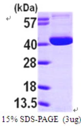 Human Ogg1 protein, His tag. GTX67604-pro