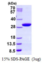 Human PAFAH1B3 protein, His tag. GTX67608-pro