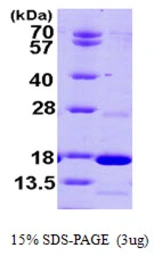 Human PDE6D protein, His tag. GTX67620-pro